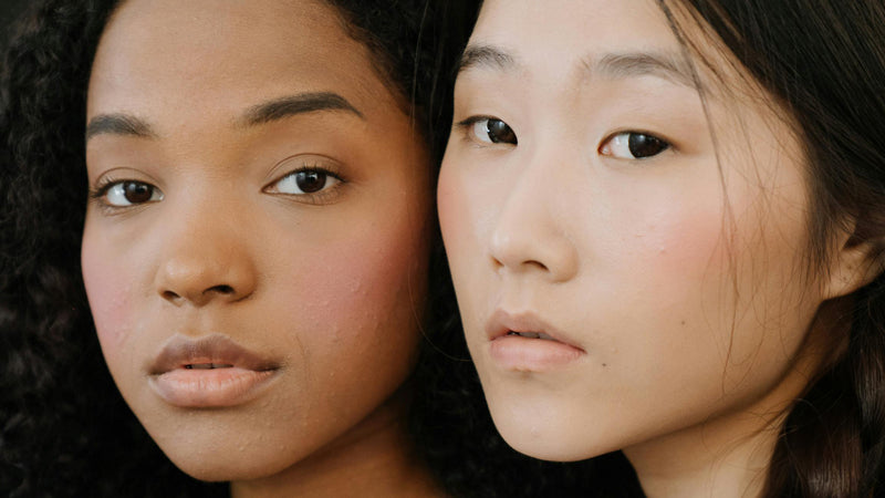 Hoe bepaal je jouw huidtype?