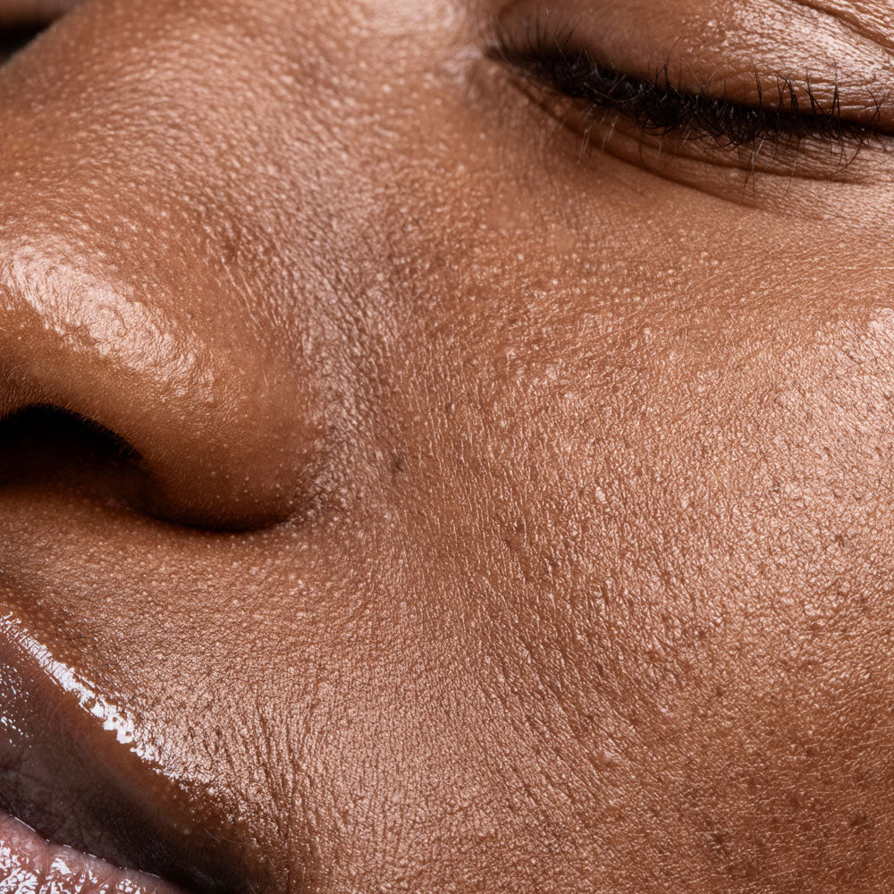 Zo is de huid opgebouwd